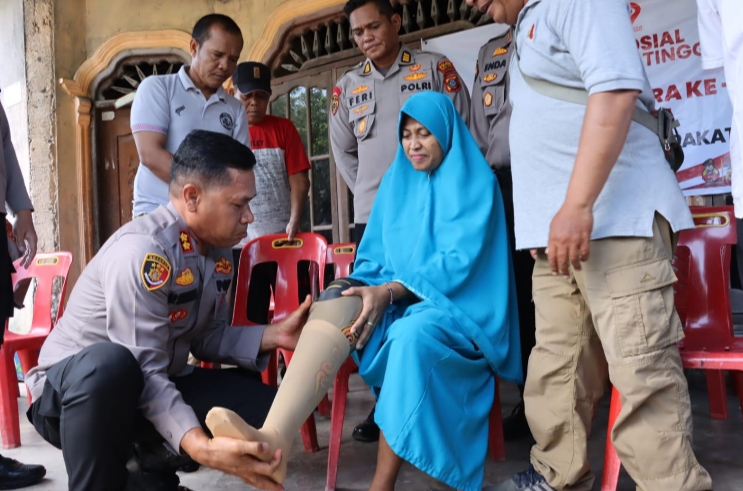 HUT Bhayangkara ke 79, Polres Tebing Tinggi Berikan Kaki Palsu dan SIM Gratis Bagi Penyandang Disabilitas