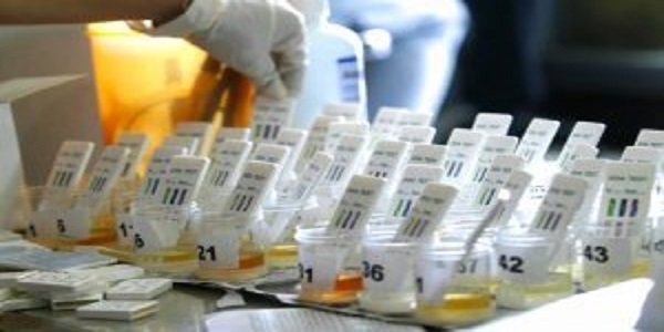Kapolri : Tes Urine Anggota Per 3 Bulan